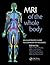 MRI of the Whole Body: An Illustrated Guide for Common Pathologies