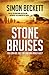 Stone Bruises