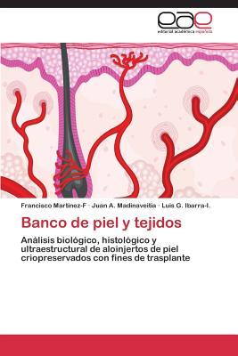 Banco de piel y tejidos: Análisis biológico, histológico y ultraestructural de aloinjertos de piel criopreservados con fines de trasplante (Spanish Edition)