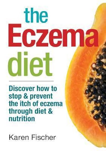 The Eczema Diet: Discover How to Stop and Prevent The Itch of Eczema Through Diet and Nutrition