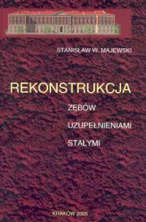 Rekonstrukcja zębów uzupełnieniami stałymi