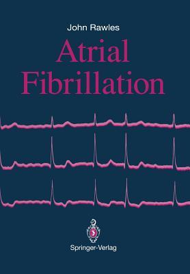 Atrial Fibrillation
