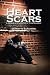 Heart Scars
