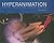 Hyperanimation: Digital Images and Virtual Worlds
