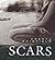 Scars