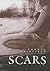 Scars