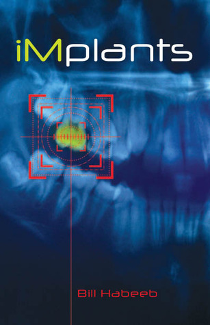 iMplants