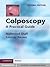 Colposcopy: A Practical Guide