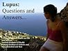 Lupus Causes, Symptoms, Signs, Diagnosis and Treatments Lupus Causes, Symptoms, Signs, Diagnosis and Treatments