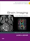 Brain Imaging: Ca...