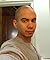 Psoriasis Simple Treatment by Gustavo Sanchez