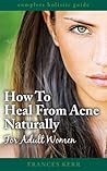 How To Heal From Acne Naturally: For Adult Women