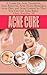 Acne Cure - A Guide For Acne Treatment, Acne Removal, Acne Home Remedies, Acne Diet, and Acne Control So That You Can Get Acne Relief Once And For All
