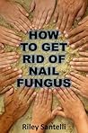 How to Get Rid of Nail Fungus