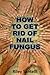 How to Get Rid of Nail Fungus