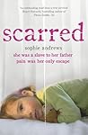 Scarred: She was ...