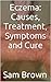 Eczema: Causes, Treatment, ...