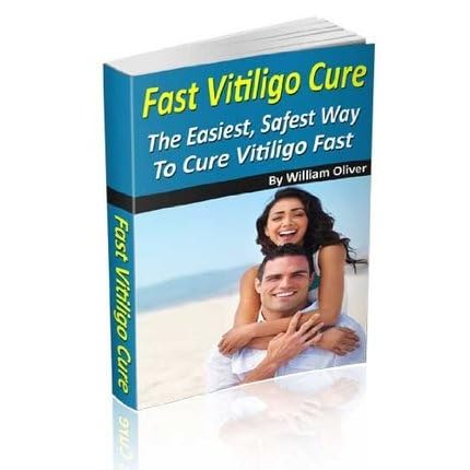 cure vitiligo in 30 days