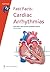 Cardiac Arrhythmias (Fast Facts)