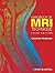 Handbook of MRI Technique