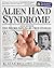 Alien Hand Syndrome