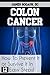 Colon Cancer: How to Prevent it or Survive it in 12 Easy Steps