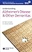 Alzheimer's Disease + Other Dementias (Understanding) by James Warner