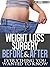 Weight Loss Surgery - Everything You Wanted To Know - Before ... by Michell Border Weight Loss Surgery - Everything You Wanted To Know - Before ... by Michell Border