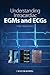 Understanding Intracardiac EGMs and ECGs