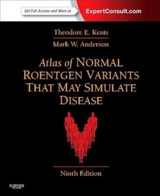 Atlas of Normal Roentgen Variants That May Simulate Disease