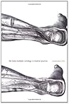 Book cover for The Body Multiple: Ontology in Medical Practice (Science and Cultural Theory)