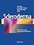 Scleroderma: From Pathogenesis to Comprehensive Management