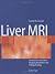Liver MRI: Correlation with...
