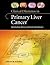 Clinical Dilemmas in Primary Liver Cancer