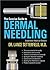 The Concise Guide to Dermal Needling Expanded Medical Edition... by Lance Setterfield The Concise Guide to Dermal Needling Expanded Medical Edition... by Lance Setterfield