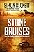 Stone Bruises
