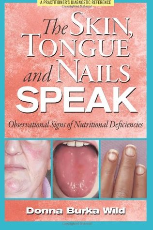 The Skin, Tongue and Nails Speak: Observational Signs of Nutritional Deficiencies (Paperback)