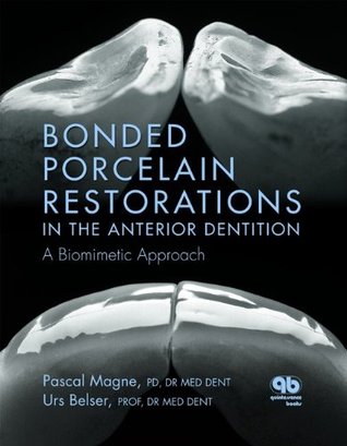 Bonded Porcelain Restorations in the Anterior Dentition: A Biomimetic Approach (Hardcover)