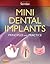 Mini Dental Implants: Principles and Practice