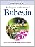 The Diagnosis and Treatment of Babesia
