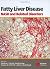 Fatty Liver Disease by Geoffrey C. Farrell