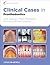 Clinical Cases in Prosthodontics (Clinical Cases (Dentistry) Book 9)