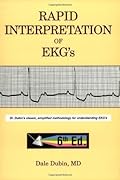 Rapid Interpretation of EKGs 