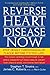 Reverse Heart Disease Now: Stop Deadly Cardiovascular Plaque Before It's Too Late