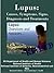 LUPUS: REVISED -CAUSES, SYMPTOMS, SIGNS, DIAGNOSIS AND TREATMENTS