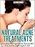 Natural Acne Treatments: Home Remedies For An Acne Cure. Treatment of Teenage Acne, Adult Acne, Acne Scars and Back Acne