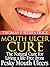Mouth Ulcer Cure