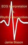 ECG Interpretation & Rhythm Recognition