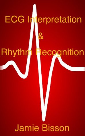 ECG Interpretation & Rhythm Recognition (Kindle Edition)