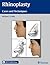 Rhinoplasty: Cases and Tech...
